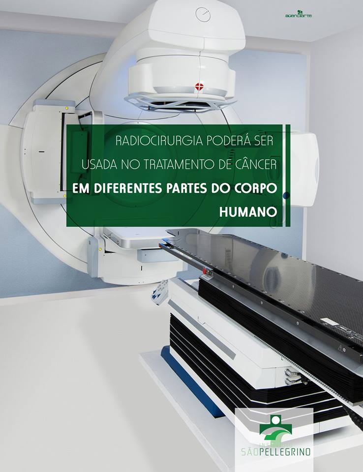 Radiocirurgia poderá ser usada no tratamento de câncer em diferentes partes do corpo humano